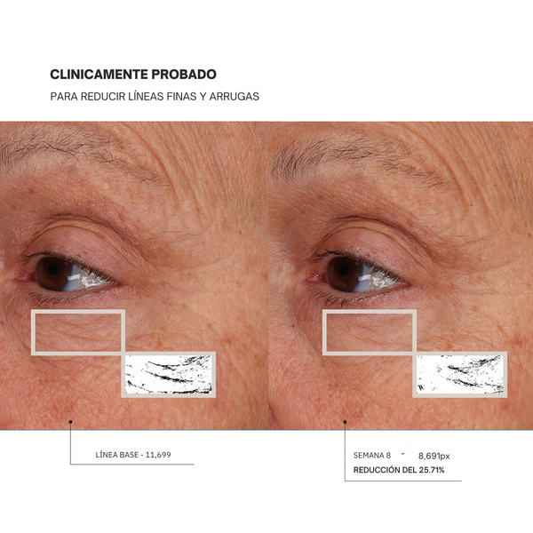 Máscara de Luz Roja