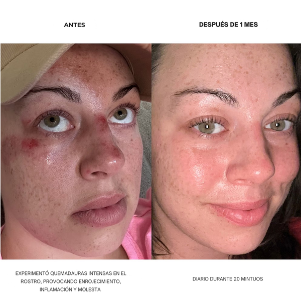 Máscara de Luz Roja