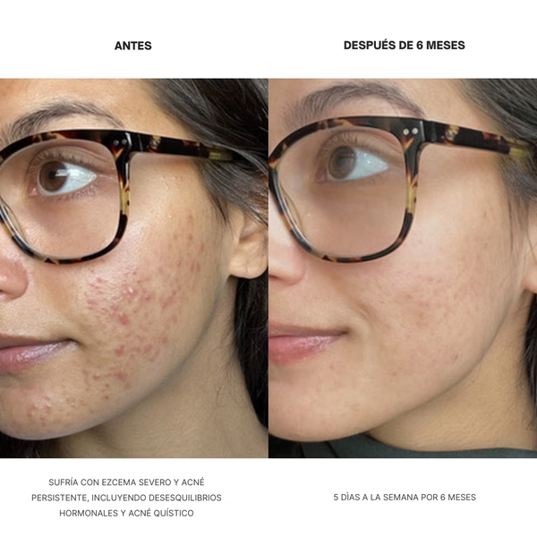 Máscara de Luz Roja