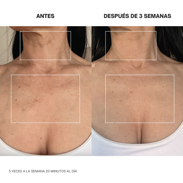 Luz Roja para Cuello