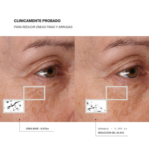HigherDose mascara de luz roja, clinicamente probado para reducir lineas finas y arrugas