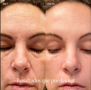antes y despues solawave luz roja facial resultados en piel